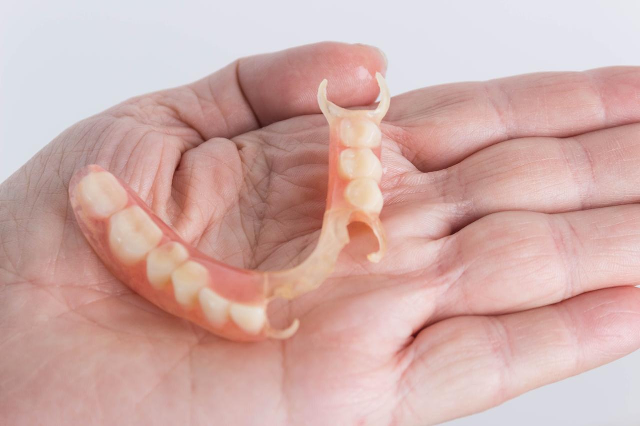 Root canal treatment