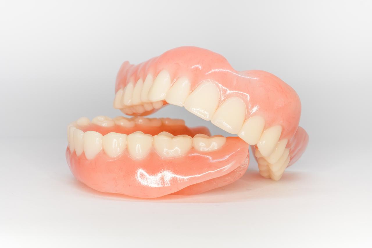 Surgical extractions