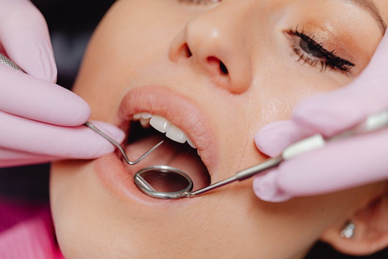 Gum Health Assessments at Spixworth Dental Practice
