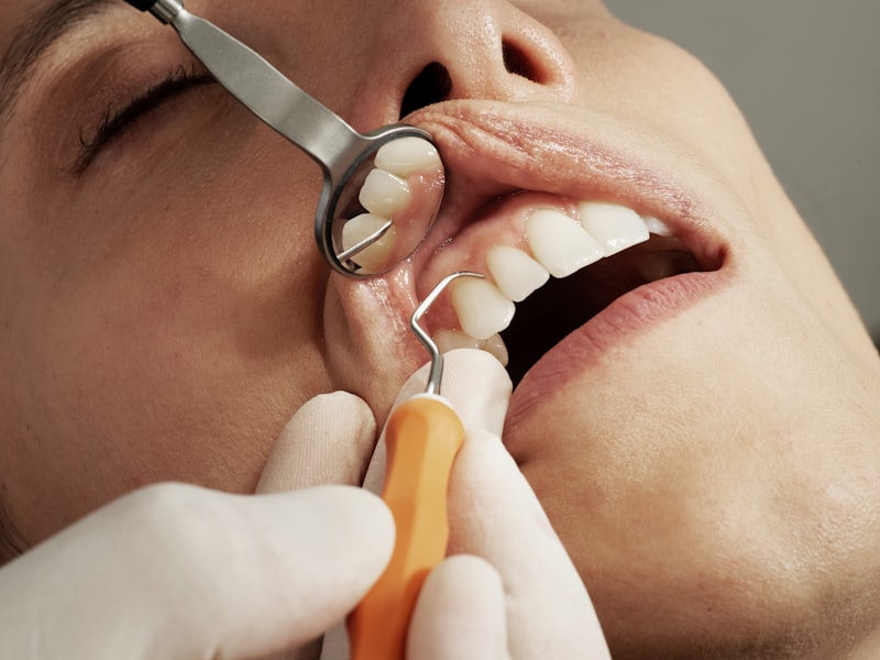 Smile Makeover at Spixworth Dental Practice