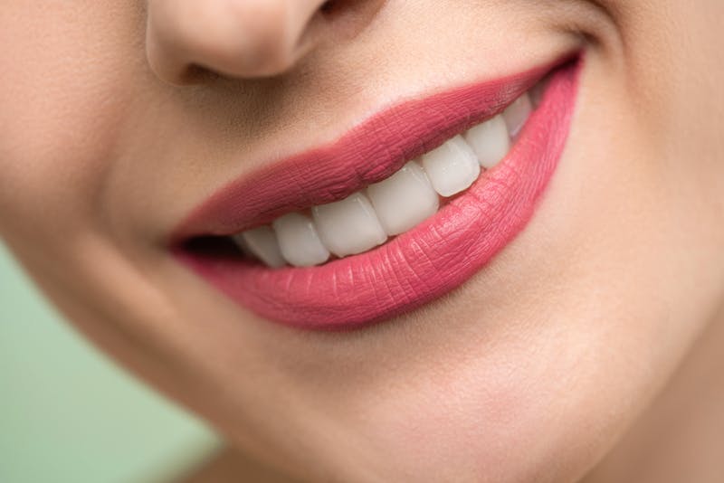 Teeth Whitening at Spixworth Dental Practice