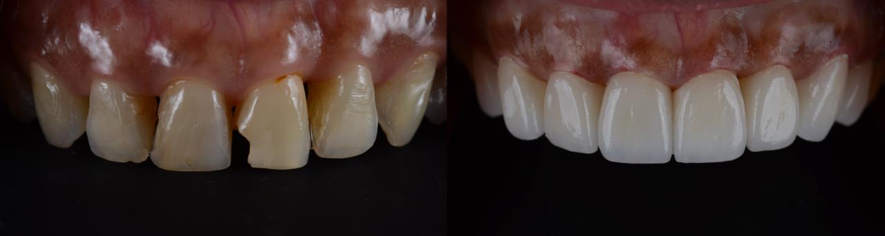 Cosmetic dentistry at Spixworth Dental Practice